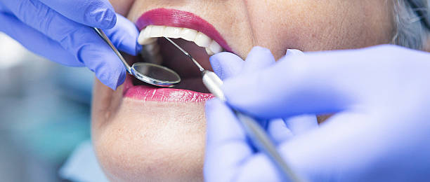Best Broken or Chipped Tooth Repair in Seneca, MO